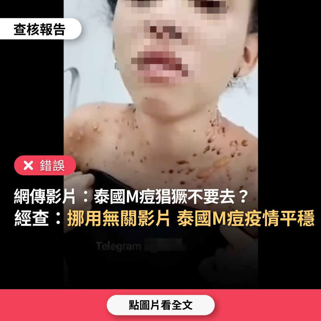 【錯誤】網傳影片「泰國M痘變異株、很嚴重，千萬不要去泰國和東南亞」？ | 台灣媒體素養計畫